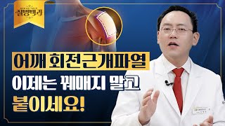 회전근개파열 힘줄 재생 치료, 콜라겐 임플란트란? | 질병백과