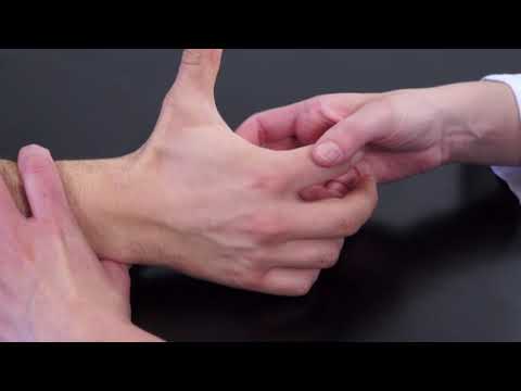 Video: ¿Podría haberme fracturado el pulgar?