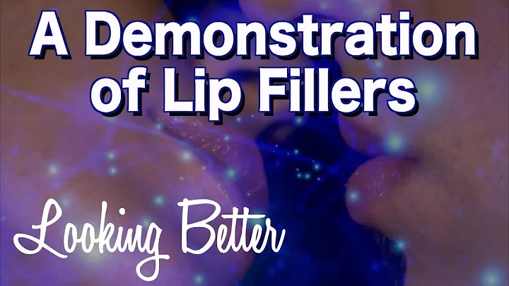 A demonstration of lip fillers- stop the aging-Lip...