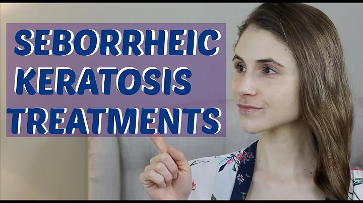 SEBORRHEIC KERATOSIS TREATMENTS (INCLUDING ESKATA)...
