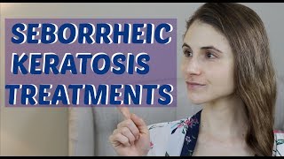 SEBORRHEIC KERATOSIS TREATMENTS (INCLUDING ESKATA)| DR DRAY