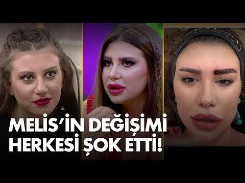 Kısmetse Olur'un Melis'i estetikli haliyle şaşırttı! - Müge ve Gülşen'le 2. Sayfa