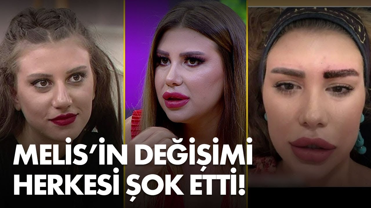 Kismetse Olur Un Melis I Estetikli Haliyle Sasirtti Muge Ve Gulsen Le 2 Sayfa Youtube