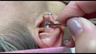 Ear cleaning. How does a beautician clean the ear? تنظيف الأذن. كيف ينظف خبير التجميل الاذن؟