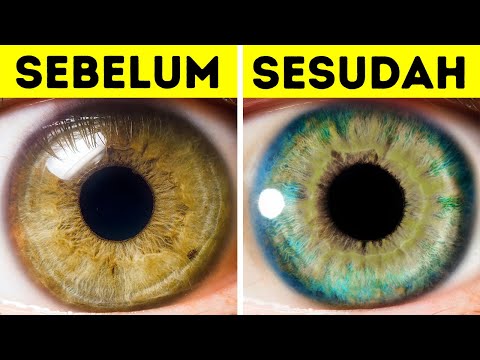 Video: Pigmen Biru dan Hijau Tidak Ada dalam Iris Manusia, Jadi Bagaimana Ada Orang Yang Mempunyai Mata Biru dan Hijau?