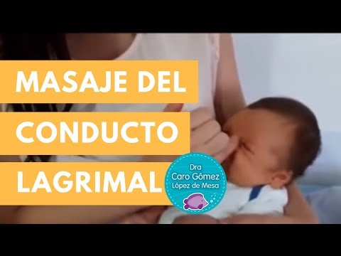 Video: Cómo limpiar un conducto lagrimal bloqueado: 12 pasos (con imágenes)