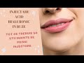 BUZE NATURALE CU ACID HIALURONIC  |  DE CE TIGARILE DEFORMEAZA BUZELE  | Dr. Ioana Tuhar