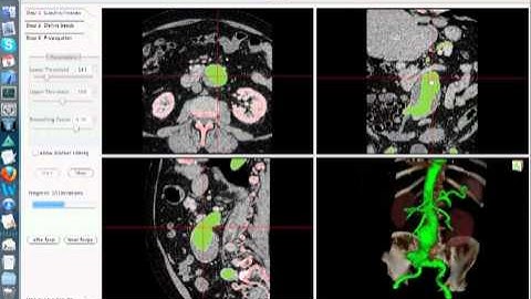 MIALite Introduction I: How to use MIALite for 3D segmenation