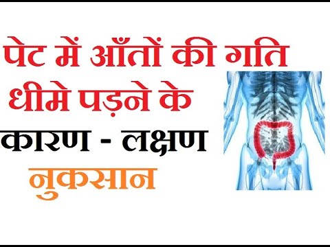 वीडियो: वेग बढ़ने का क्या कारण है?