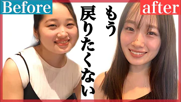 小顔マッサージ 小顔マッサージ