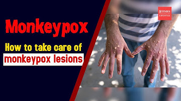 How to take care of monkeypox lesions