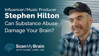 Influencer/Music Producer Stephen Hilton Can Substance Abuse Damage Your Brain