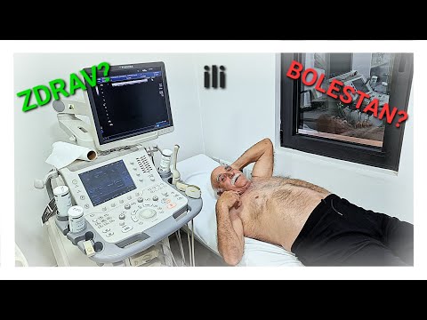 OD ČEGA BOLUJE