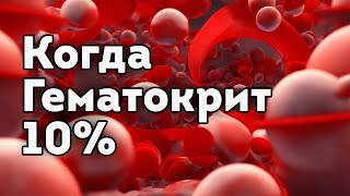 Гематокрит 10%