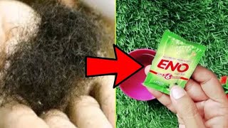 नीचे के बालों को 5 मिनट में जड खत्म करने का घरेलू उपाय || Unwanted Hair Removal At Home | By Monty's