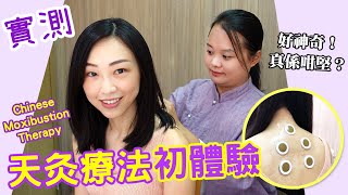 【實測】天灸療法真係咁勁？告別虛寒體質！M痛？鼻敏感？手腳冰冷？吳盈盈醫師 中醫治療 三伏天灸  Moxibustion Therapy Chinese therapy experience