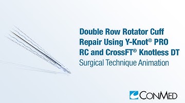 Double Row Rotator Cuff Repair Using Y-Knot® PRO RC and CrossFT® Knotless DT - CONMED Animation