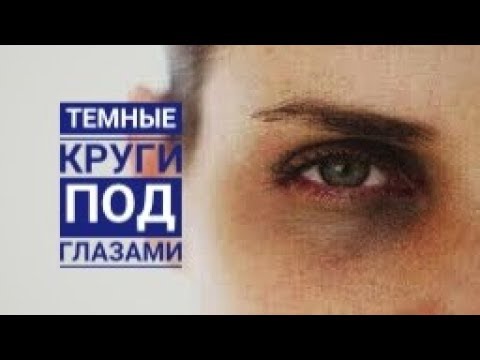 Как убрать ТЁМНЫЕ КРУГИ ПОД ГЛАЗАМИ? Аптечные средства от синяков под глазами