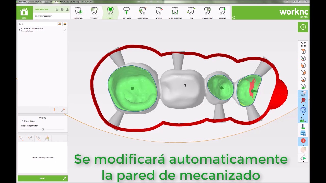 WorkNC Dental. Novedades 2017 R2