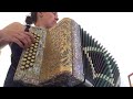 Concertina - a Mulher Gorda