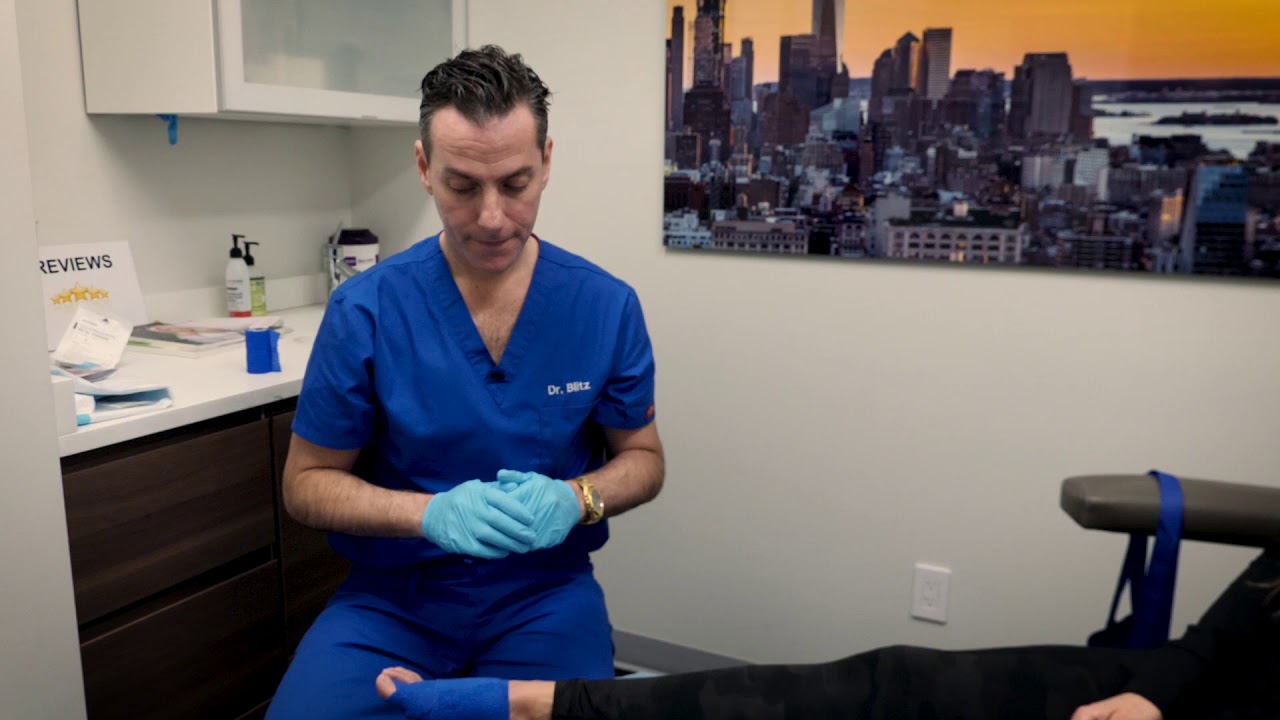 Post Bunion Surgery Physical Therapy