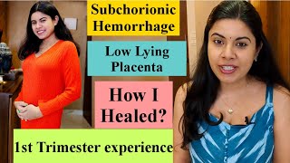 PREGNANCY First TRIMESTER experience | Subchorionic Hemorrhage | Low Lying Placenta