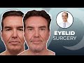 Eye Aging 101: How to Look More Refreshed | Eyelid Surgery | Dr. David Stoker
