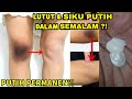 CARA MEMUTIHKAN LUTUT, SIKU, SEL4NGK4NGAN, KETI4K, P4NTAT DAN LEHER DENGAN CEPAT!!