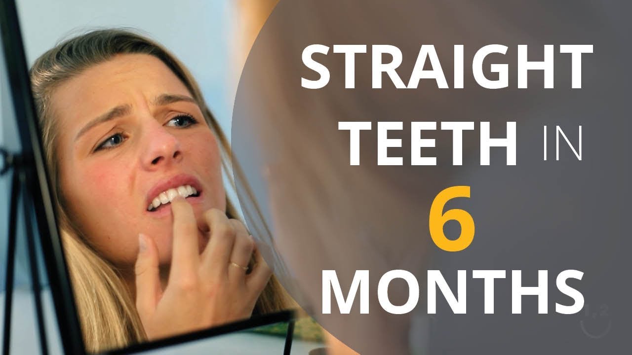 Annie's Straight Smile Journey | OneTwoSmile