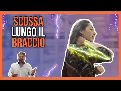 Video: Quanto costa un braccio di controllo superiore?