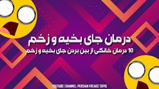 ویدئو آموزشی - ۱۰ درمان خانگی از بین بردن جای بخیه و زخم 