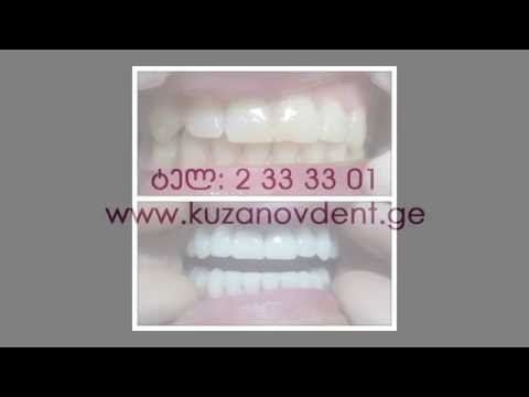 Kuzanov Dent | კუზანოვ დენტი