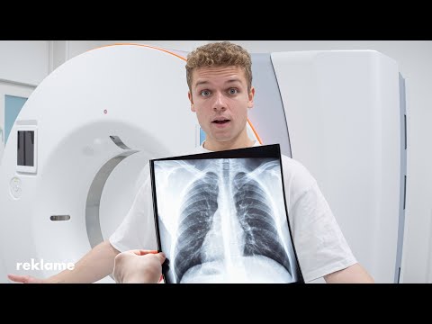 Video: Hvad er forlængelse i radiografi?