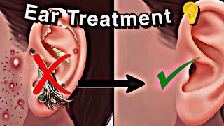 ASMR Satisfying ? Piercing Pus Treatment Animation, Ear Acne Blackhead Extrusion, Sebaceous Cyst.