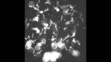 Bestrophin 1 is indispensable for volume regulation in human retinal pigment epithelium cells