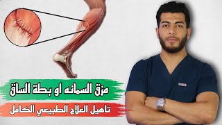 علاج تمزق عضلة السمانه بخطوات بسيطة |تمزق بطة الساق| علاج التمزق العضلى قى اسرع وقت