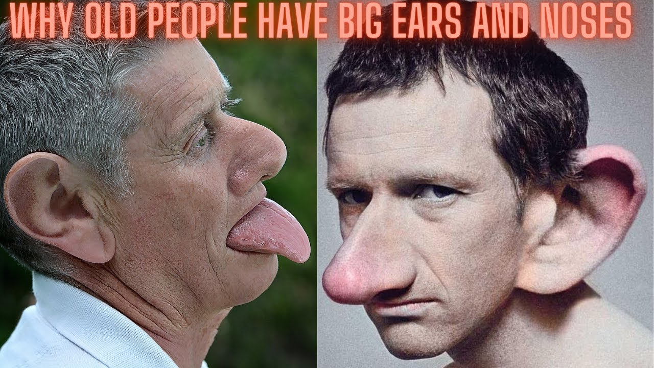 Why Old People Have Big Ears And Noses Not Other Parts Youtube