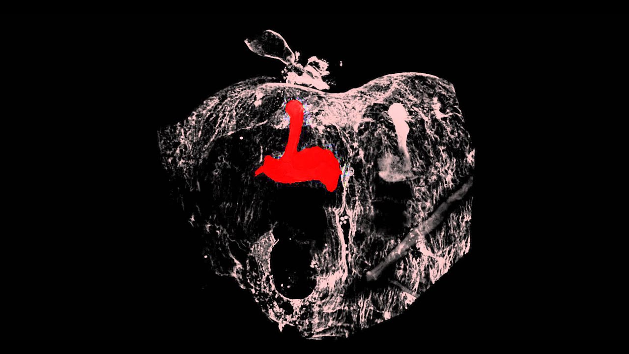 Drosophila Mushroom Body and FasII Staining