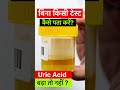 High Uric Acid Warning Sign You य 3 लक षण द ख त स वध न ह ज ए Shorts Health Facts Food 