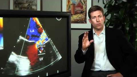 HDL Cholesterol: A Cardiologist