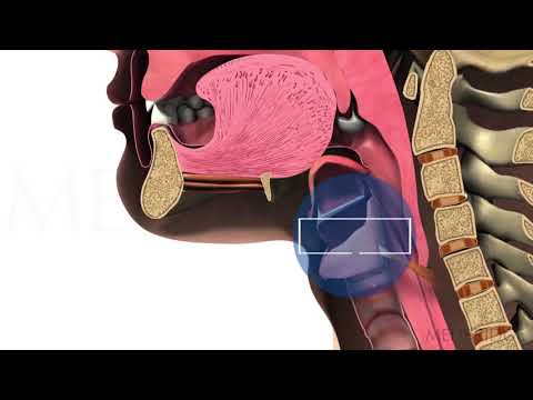 Functioning of the Upper Esophageal Sphincter Pain - Michael Groher | MedBridge