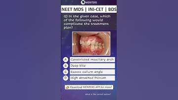 NEET MDS | INI-CET MDS | PSC | BDS - Most Important Questions  #neetmds2025 #mdsprep