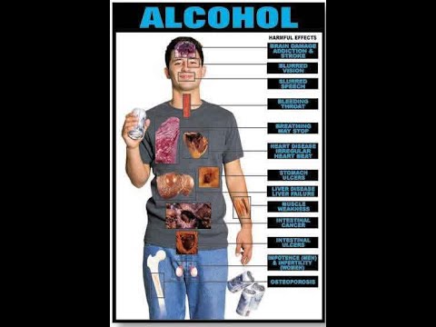 Bağımlılık nedir ?