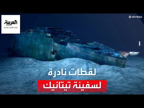 فيديو: ماذا يحدث إذا قمت بإزالة نصف الدماغ؟