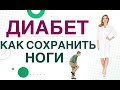 💊 Сахарный диабет. Осложнения. Диабет стопа, как сохранить ноги? Врач эндокринолог Ольга Павлова.