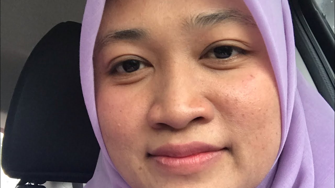 Cara Mengatasi Luka Pembedahan Supaya Cepat Sembuh