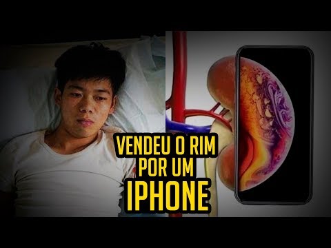 Vídeo: Jovem Vende Rim Para Comprar Um IPhone