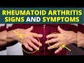 Rheumatoid Arthritis kya hota hai in hindi | Rheumatoid Arthritis के कारण क्या है ?