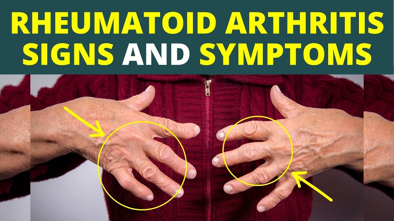 Rheumatoid Arthritis kya hota hai in hindi Rheumatoid Arthritis के