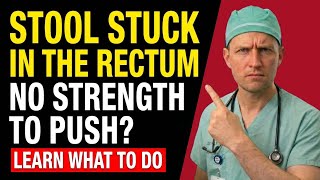 STOOL STUCK IN THE RECTUM! WHAT IS IT AND WHAT TO DO?
